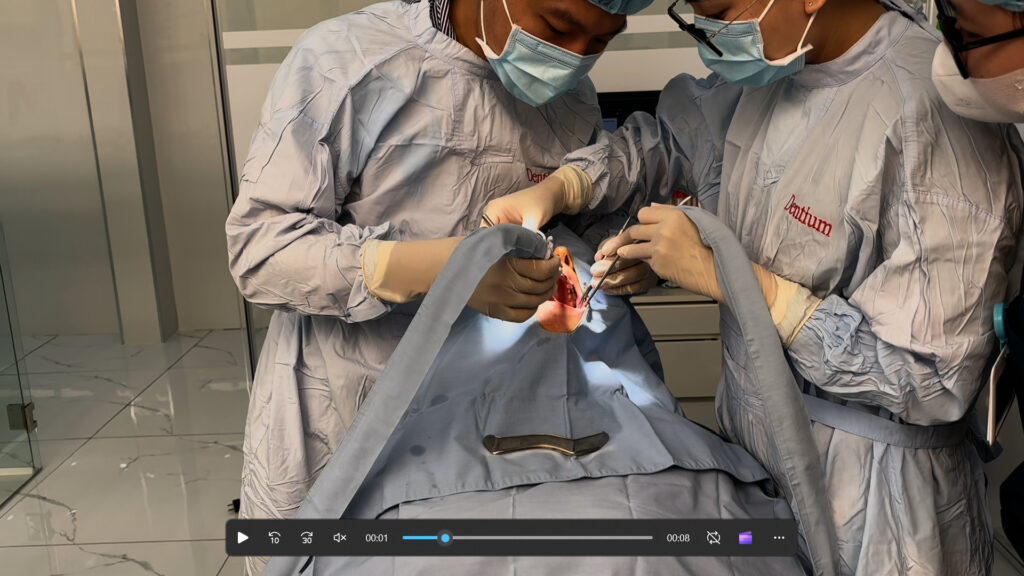 Dental Implants Vung Tau by Dentist Vung Tau